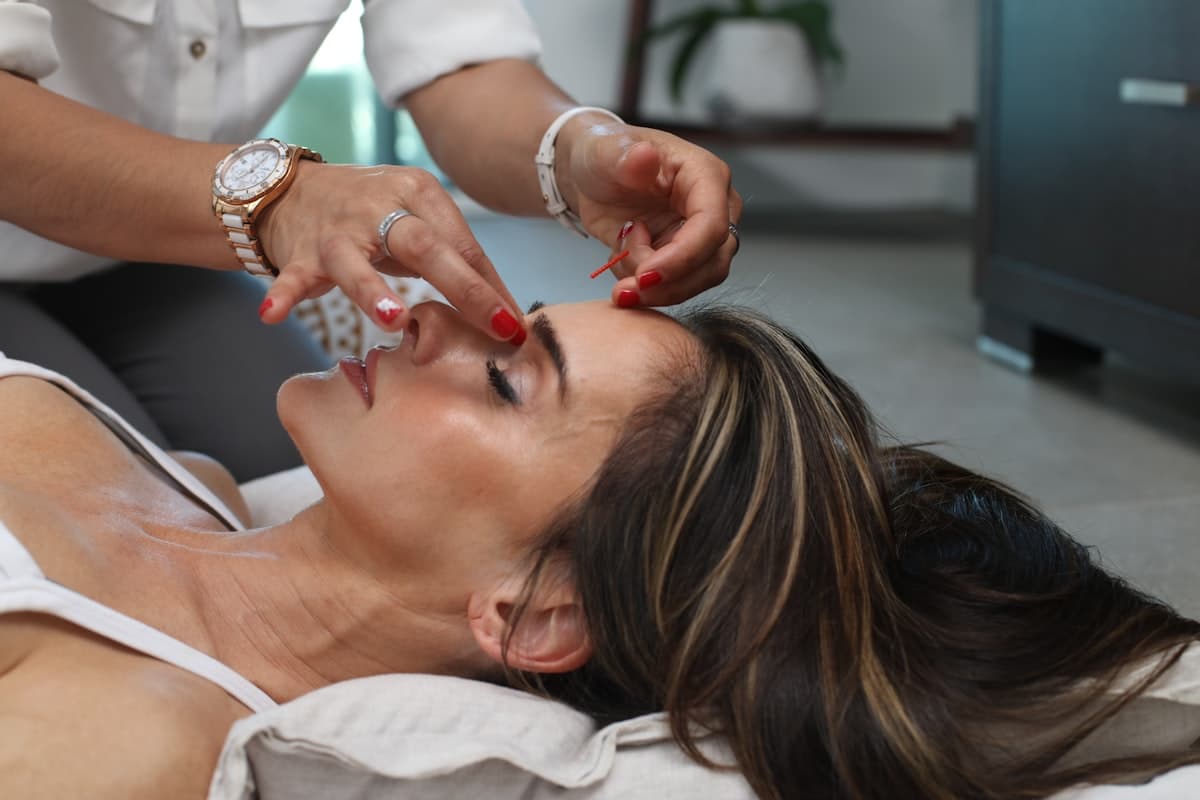 Chemical Peels